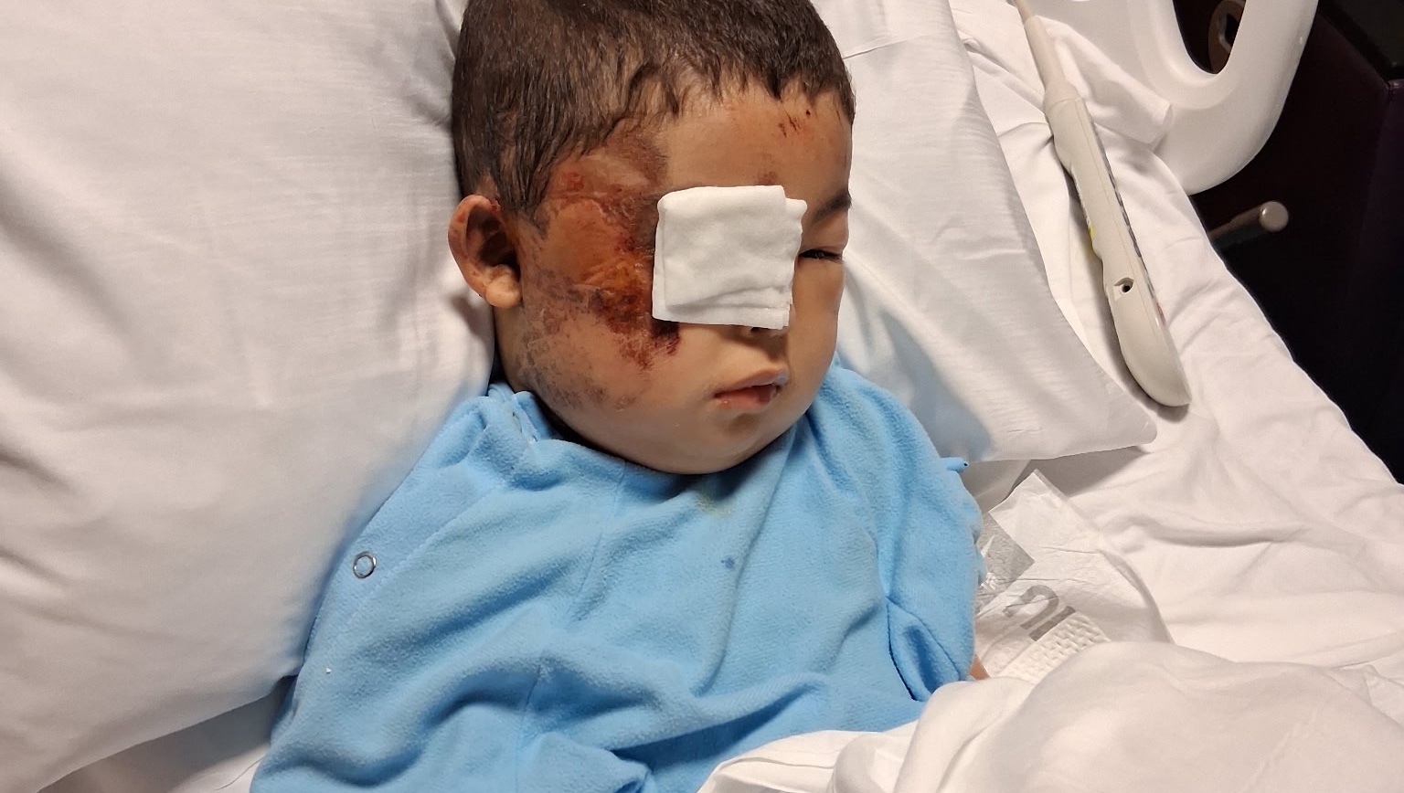 Community rallies for injured 4 year old who lost his mom in collision