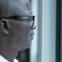 Ese Sifo of Bethesda is the first man in the state of Maryland to receive a new sickle cell gene therapy